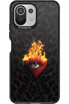 Shit happens - Xiaomi Mi 11 Lite (2021)