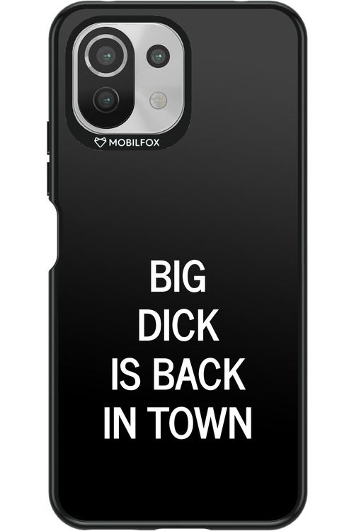 Big D*ck Black 2.0 - Xiaomi Mi 11 Lite (2021)