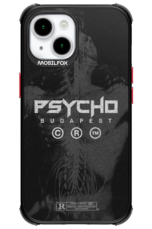 X-Ray - Apple iPhone 15