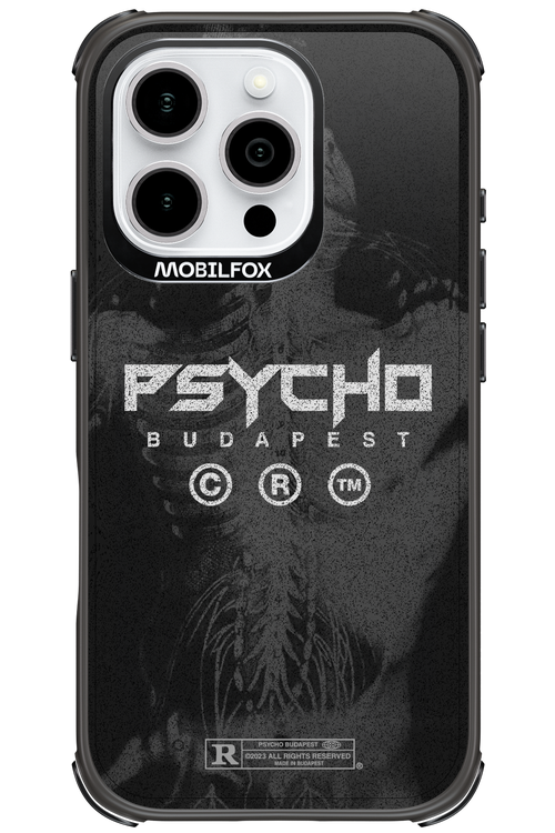 X-Ray - Apple iPhone 16 Pro