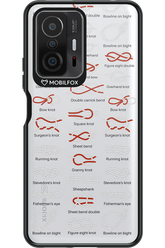 Knot Master 2.0 - Xiaomi Mi 11T Pro