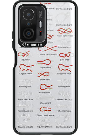 Knot Master 2.0 - Xiaomi Mi 11T Pro