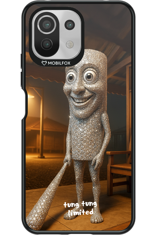 Tung Tung Limited - Xiaomi Mi 11 Lite (2021)