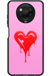 Heart Pink - Xiaomi Poco X3 Pro