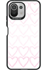 Lovelyy - Xiaomi Mi 11 Lite (2021)
