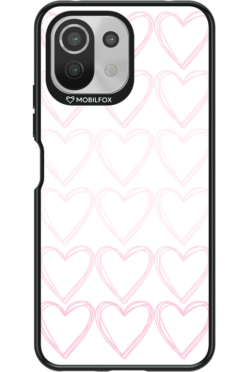 Lovelyy - Xiaomi Mi 11 Lite (2021)