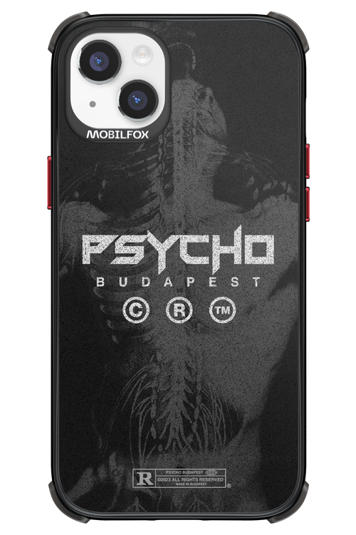 X-Ray - Apple iPhone 14 Plus