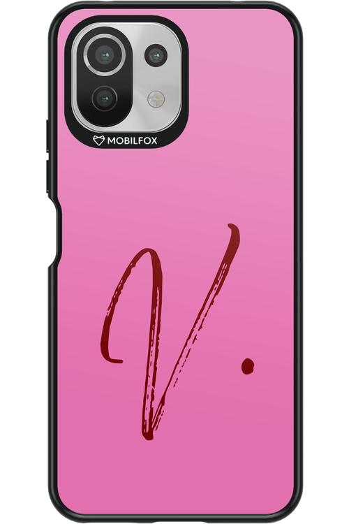 (Sorbet) V 2.0 - Xiaomi Mi 11 Lite (2021)