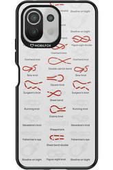 Knot Master 2.0 - Xiaomi Mi 11 Lite (2021)