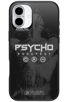 X-Ray - Apple iPhone 16 Plus