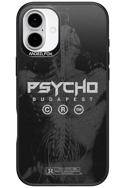X-Ray - Apple iPhone 16 Plus