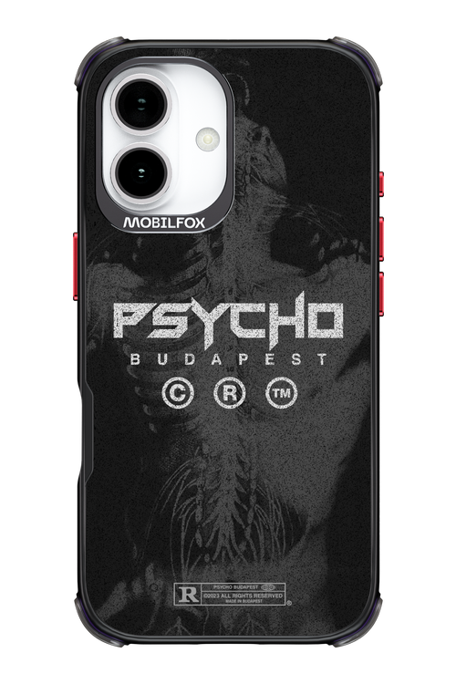 X-Ray - Apple iPhone 17