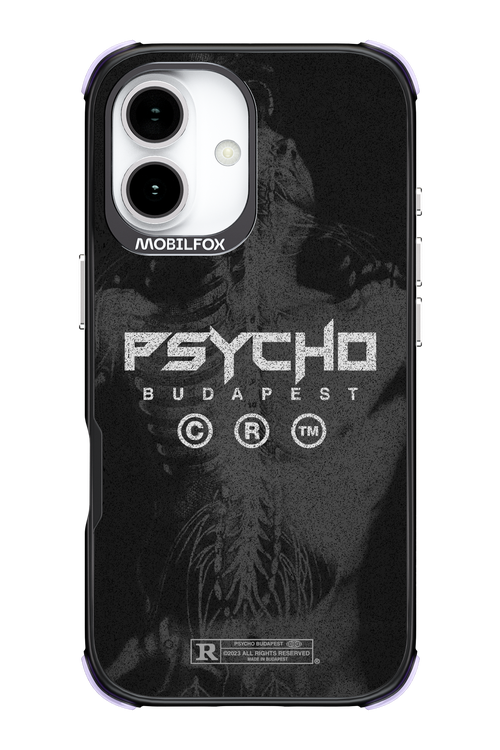 X-Ray - Apple iPhone 17
