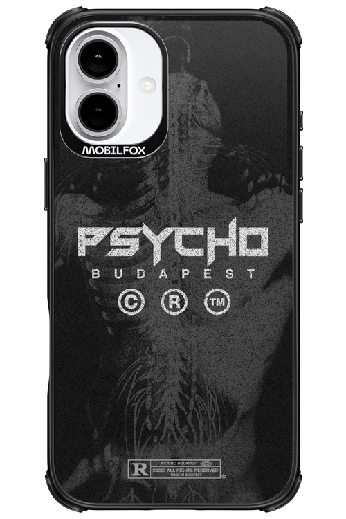 X-Ray - Apple iPhone 16 Plus
