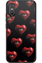 Heart Eyes - Xiaomi Redmi 9A