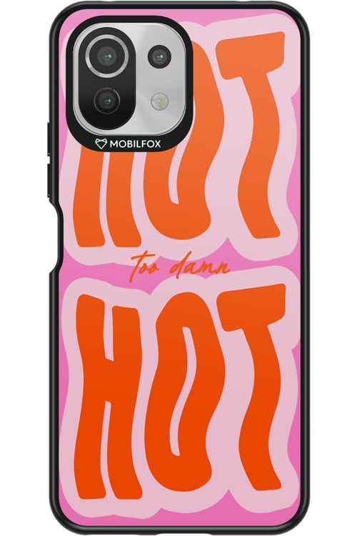 Too Damn Hot - Xiaomi Mi 11 Lite (2021)