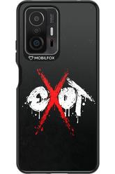 EXOT BLACK 2.0 - Xiaomi Mi 11T