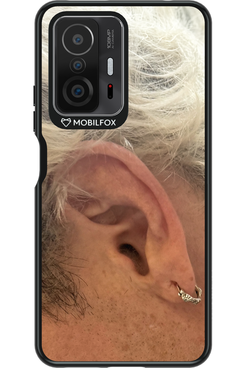 Ear 2.0 - Xiaomi Mi 11T Pro