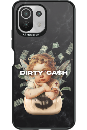 DirtyCash - Xiaomi Mi 11 Lite (2021)