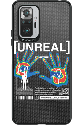 Vision - Xiaomi Redmi Note 10S