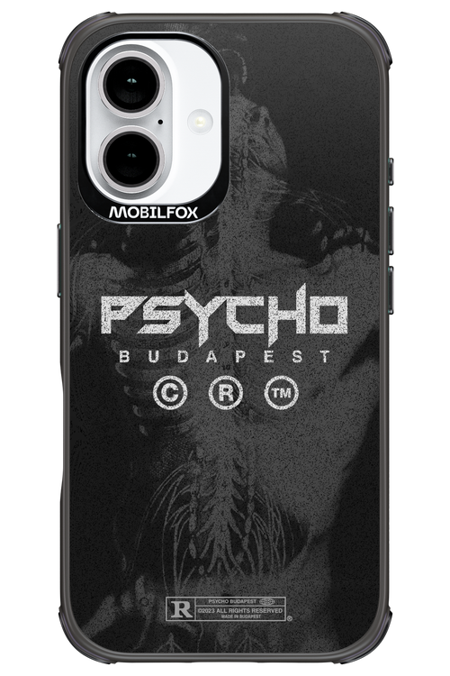 X-Ray - Apple iPhone 16