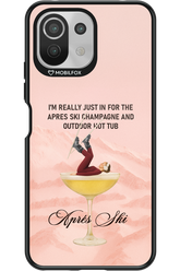 Champagne Tub - Xiaomi Mi 11 Lite (2021)