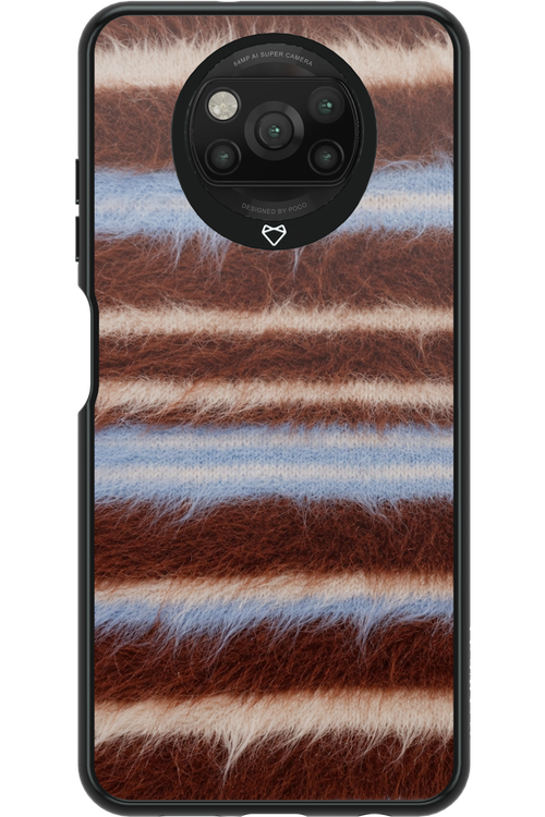 Soft Spot 2.0 - Xiaomi Poco X3 NFC
