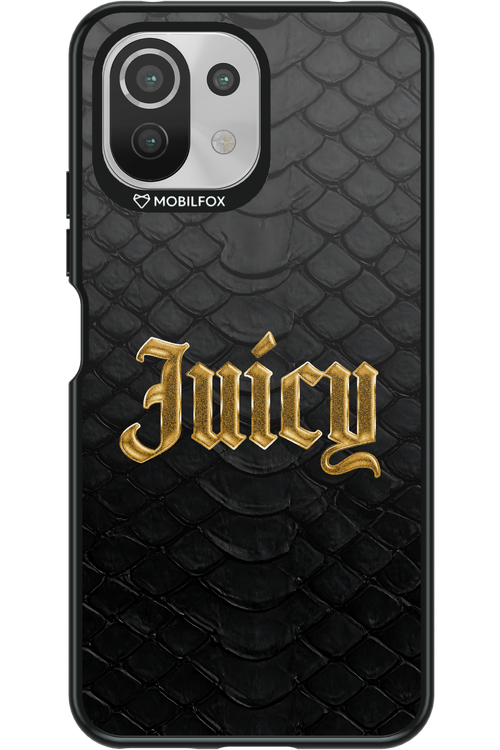 Juicy Gold 2.0 - Xiaomi Mi 11 Lite (2021)