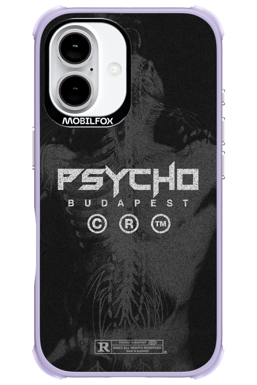 X-Ray - Apple iPhone 16