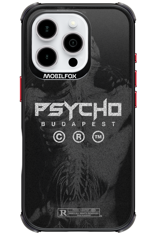 X-Ray - Apple iPhone 16 Pro