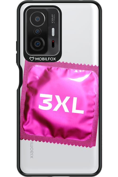 3XL 2.0 - Xiaomi Mi 11T