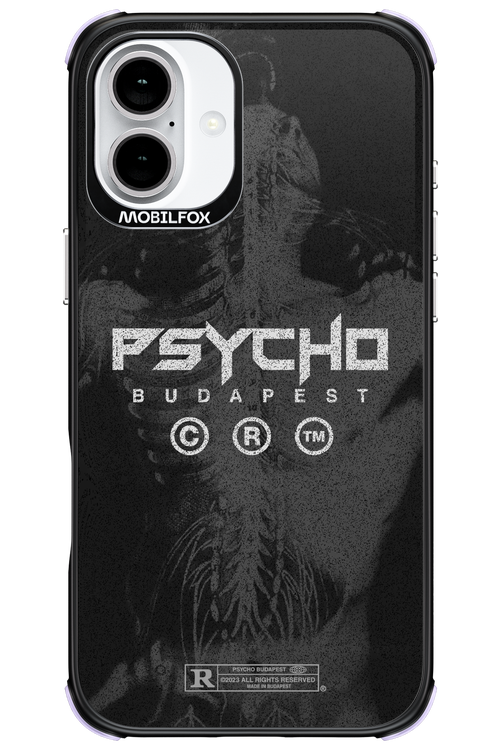 X-Ray - Apple iPhone 16 Plus