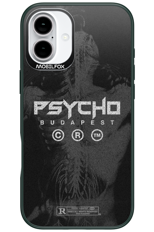 X-Ray - Apple iPhone 16 Plus